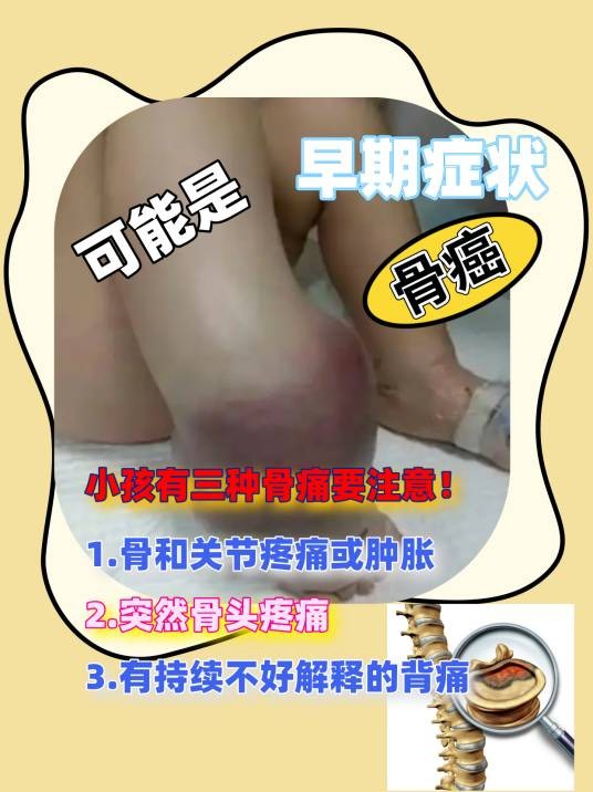 早期骨癌