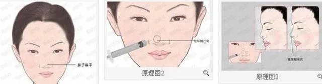 整形价位