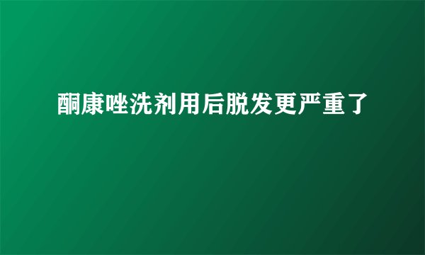 酮康唑洗剂用后脱发更严重了