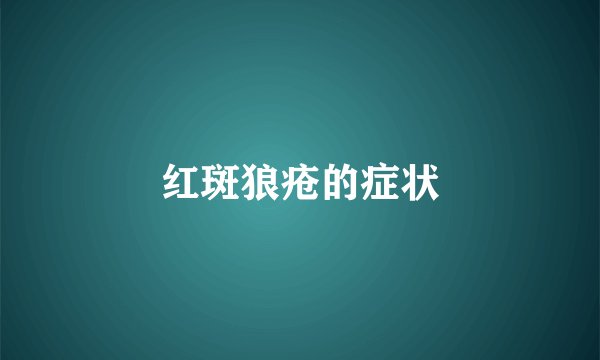 红斑狼疮的症状