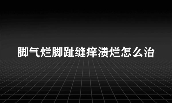 脚气烂脚趾缝痒溃烂怎么治