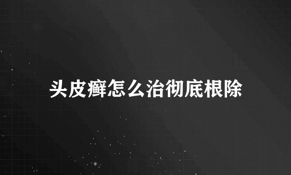 头皮癣怎么治彻底根除