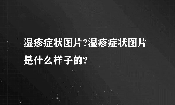 湿疹症状图片?湿疹症状图片是什么样子的?