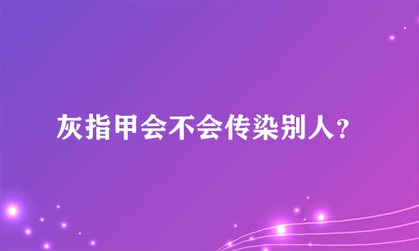 灰指甲会不会传染别人？