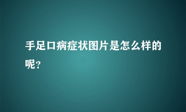 手足口病症状图片是怎么样的呢？
