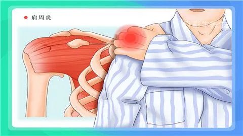背痛怎么回事