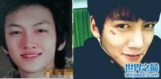 池昌旭整容前后照片对比,整容前也是一名花美男