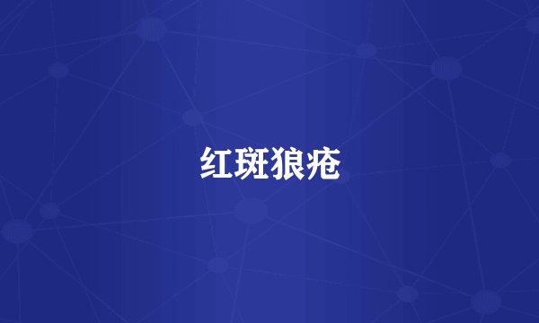 红斑狼疮