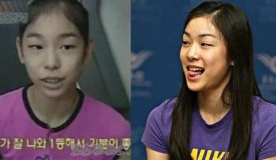 韩国女运动员有没有整容的?