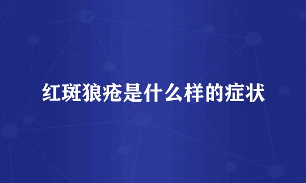 红斑狼疮是什么样的症状