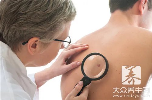  身上有出血点是什么病