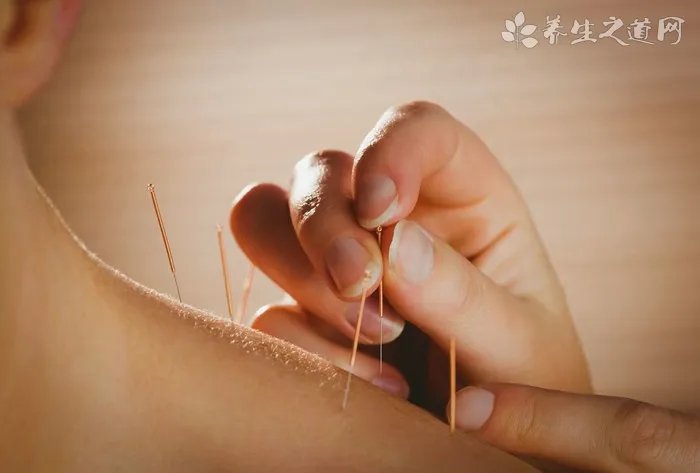 金鱼鱼鳍长白点