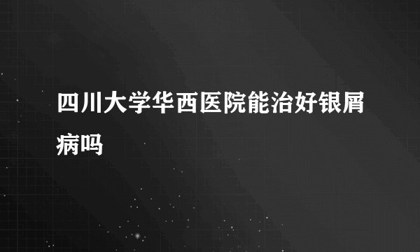 四川大学华西医院能治好银屑病吗