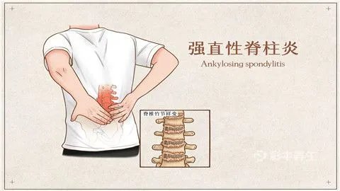 背痛怎么回事