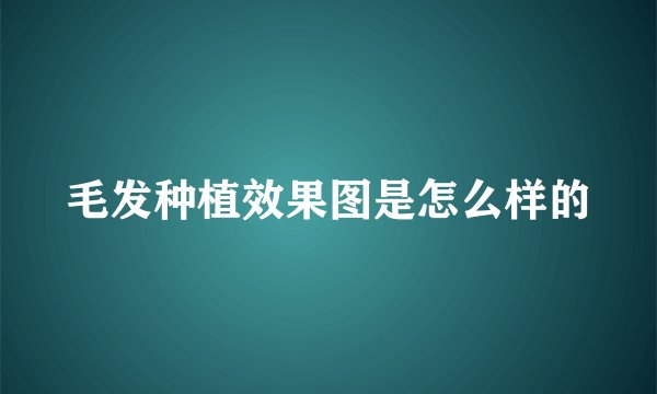毛发种植效果图是怎么样的
