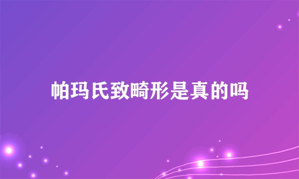 帕玛氏致畸形是真的吗