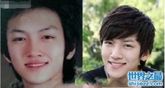 池昌旭整容前后照片对比,整容前也是一名花美男