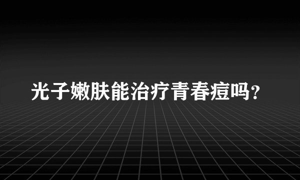 光子嫩肤能治疗青春痘吗？