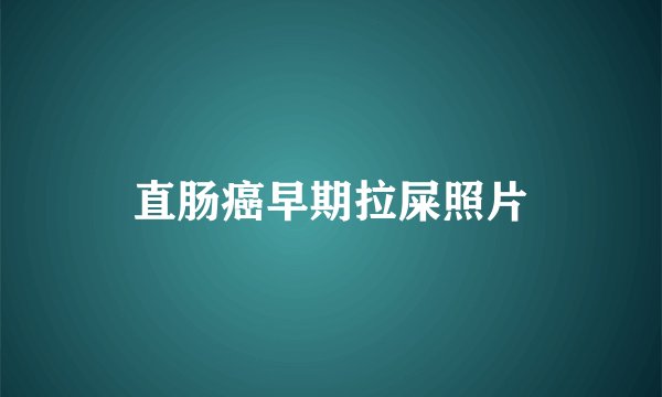 直肠癌早期拉屎照片