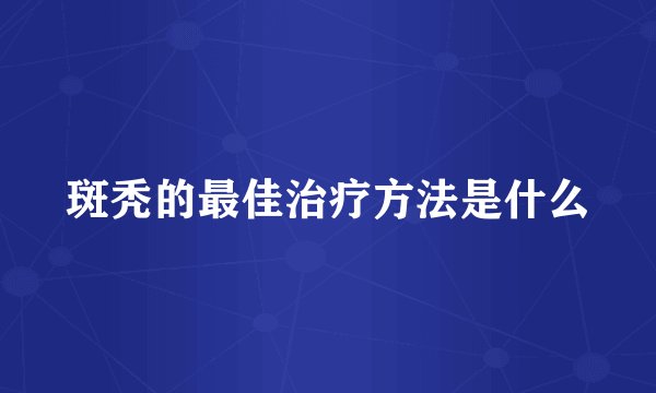 斑秃的最佳治疗方法是什么