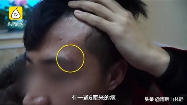 奖学金评定产生纠纷,研究生被捅伤,89天事情仍然无解,你咋看?