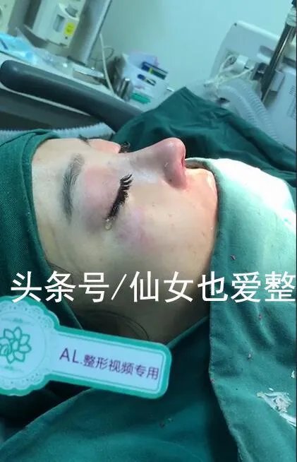 有哪些整容失败的女明星?