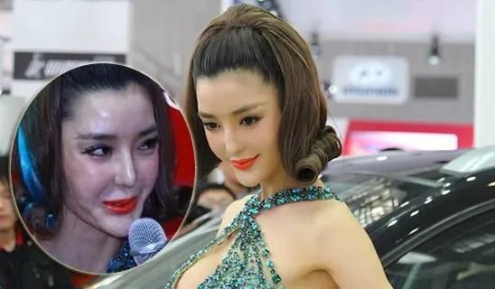 有哪些整容失败的女明星?