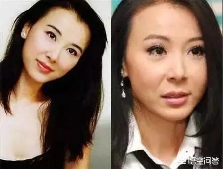 有哪些整容失败的女明星?