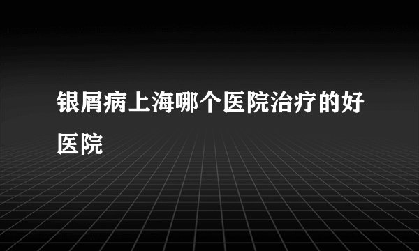 银屑病上海哪个医院治疗的好医院