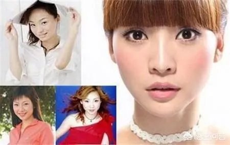 有哪些整容失败的女明星?