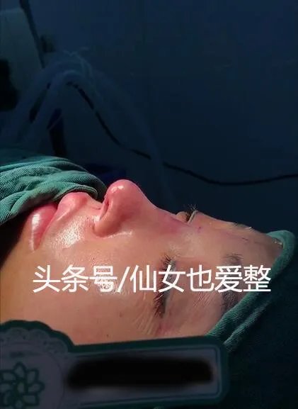 有哪些整容失败的女明星?