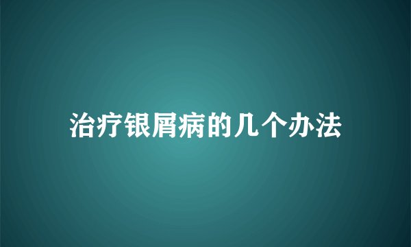 治疗银屑病的几个办法