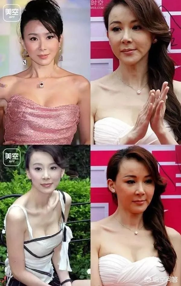 有哪些整容失败的女明星?