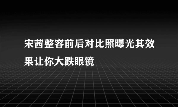 宋茜整容前后对比照曝光其效果让你大跌眼镜