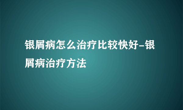 银屑病怎么治疗比较快好-银屑病治疗方法