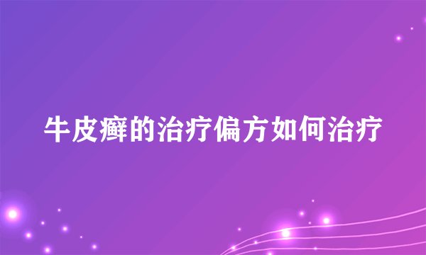 牛皮癣的治疗偏方如何治疗