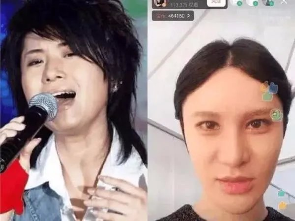 盘点娱乐圈中那些整容失败的明星都有谁?