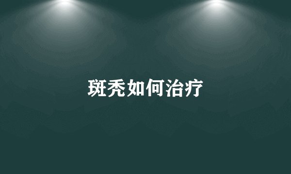 斑秃如何治疗