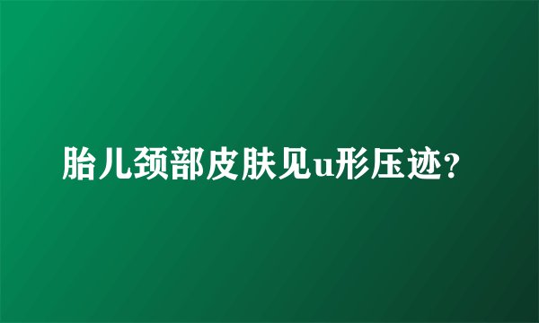 胎儿颈部皮肤见u形压迹？
