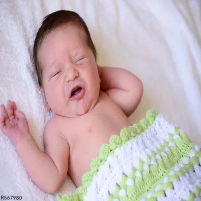 先天性肌斜颈怎么治疗 有哪些病理