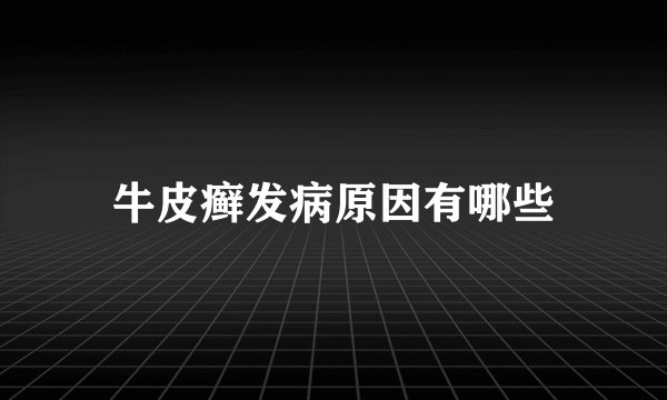 牛皮癣发病原因有哪些