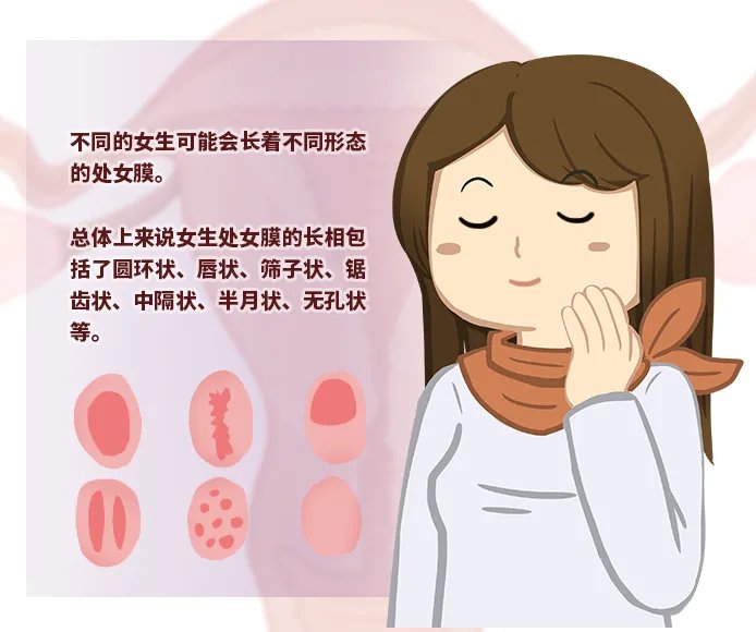 处女膜长啥样