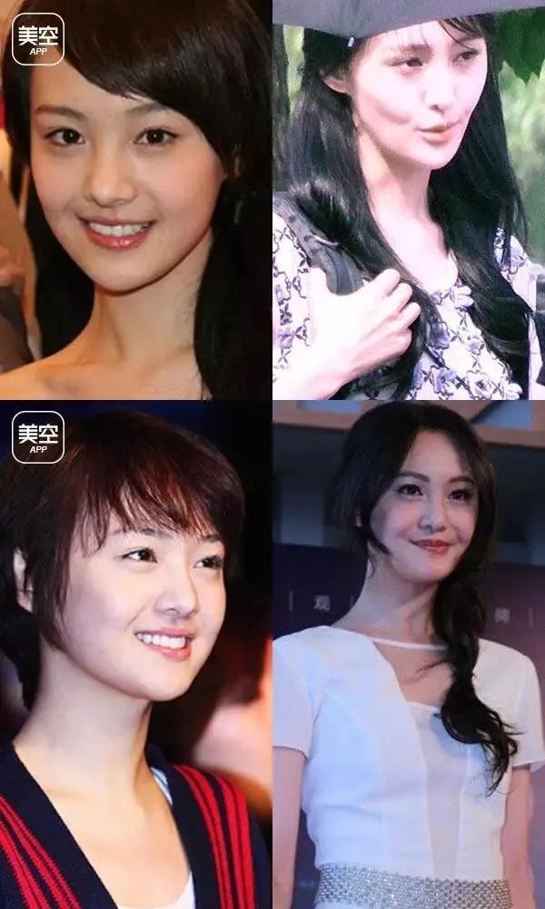 有哪些整容失败的女明星?