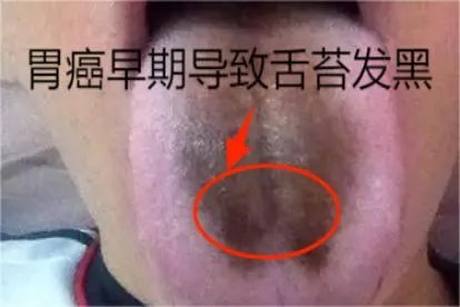 相关推荐