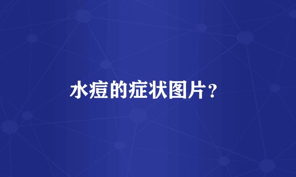 水痘的症状图片？