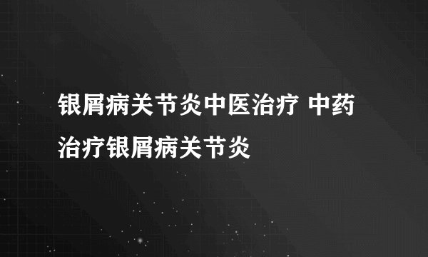 银屑病关节炎中医治疗 中药治疗银屑病关节炎