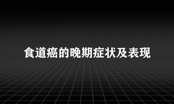 食道癌的晚期症状及表现