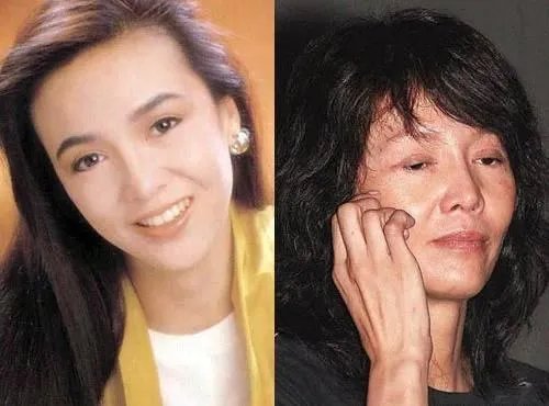 有哪些整容失败的女明星?