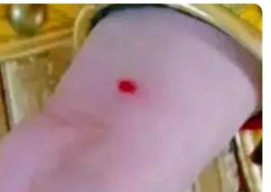 在古代守宫砂有什么作用?真的能验证贞洁吗?