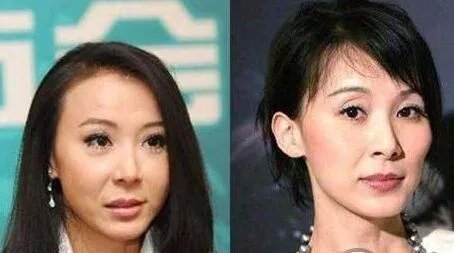 盘点娱乐圈中那些整容失败的明星都有谁？